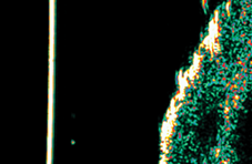 after treatment ultraspund image